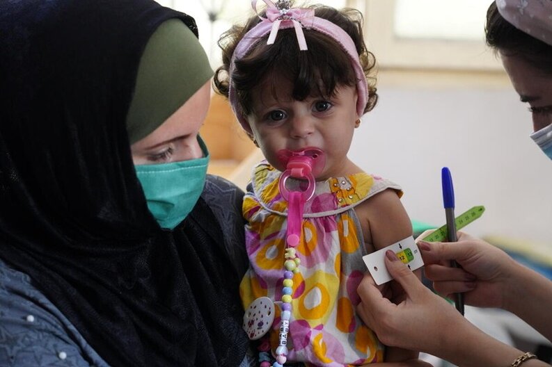 在世界粮食计划署支持的营养诊所，一名由母亲抱着的儿童在接受营养筛查时被测量中上臂围。