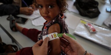 © WFP/Ali Jadallah A young child sitting on a table being measured for acute malnutrition, attending the weekly or biweekly check-ups. © WFP/Ali Jadallah