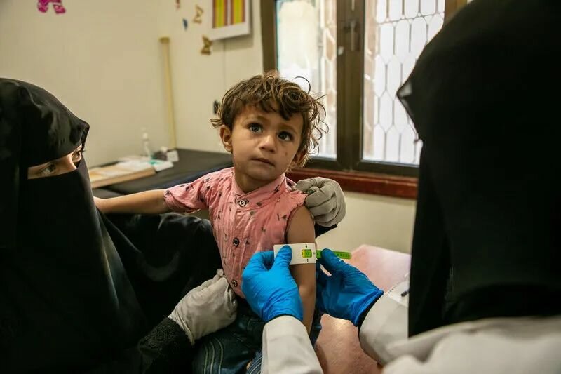 3岁的阿赫德（Ahed）在也门一家由世界粮食计划署支持的诊所接受营养不良检查。照片©WFP/Annabel Symington